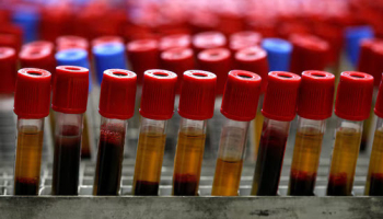 Agilent to Acquire Biocare Medical in $950M all-Cash Deal