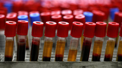 Agilent to Acquire Biocare Medical in $950M all-Cash Deal